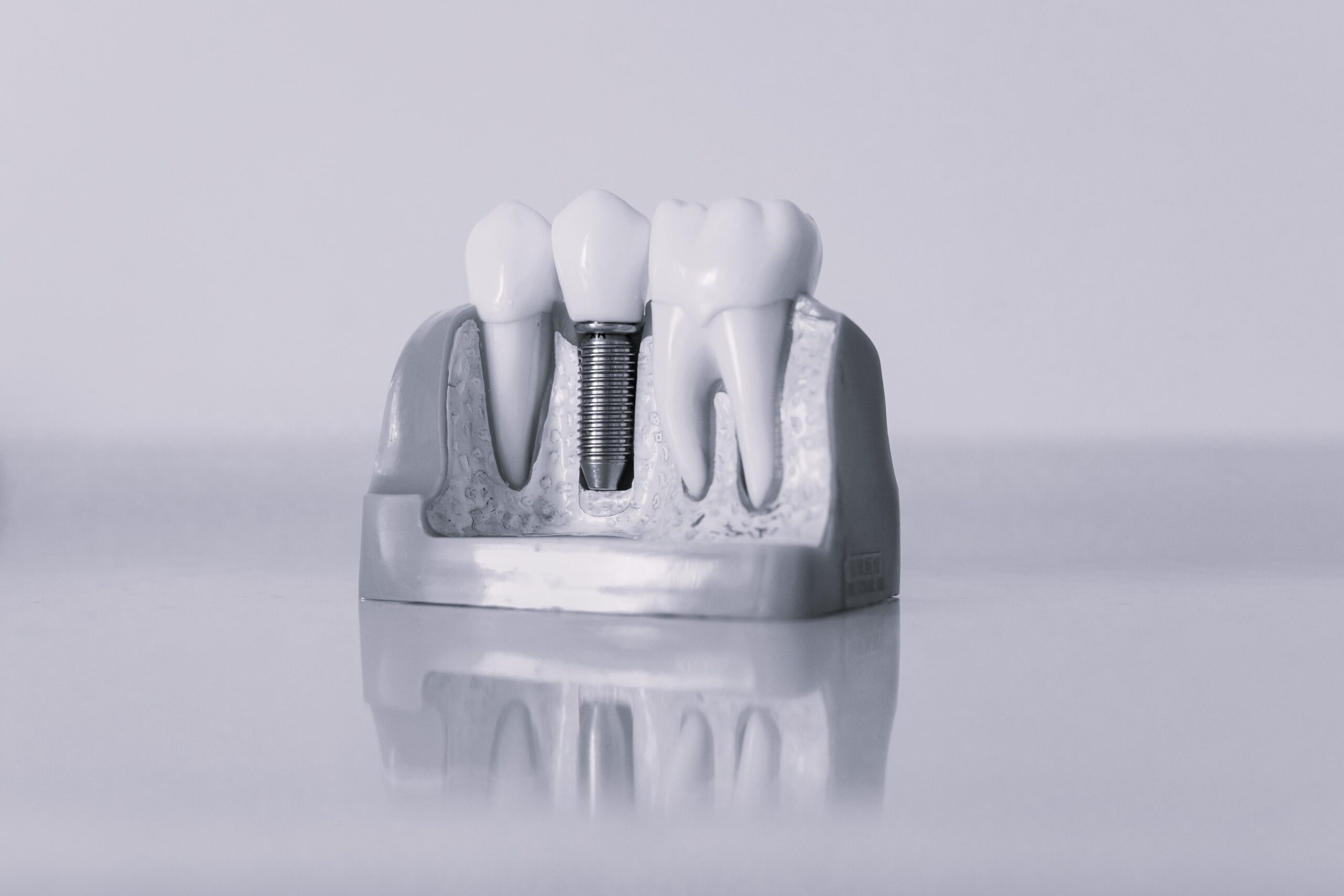 implant model, black and white