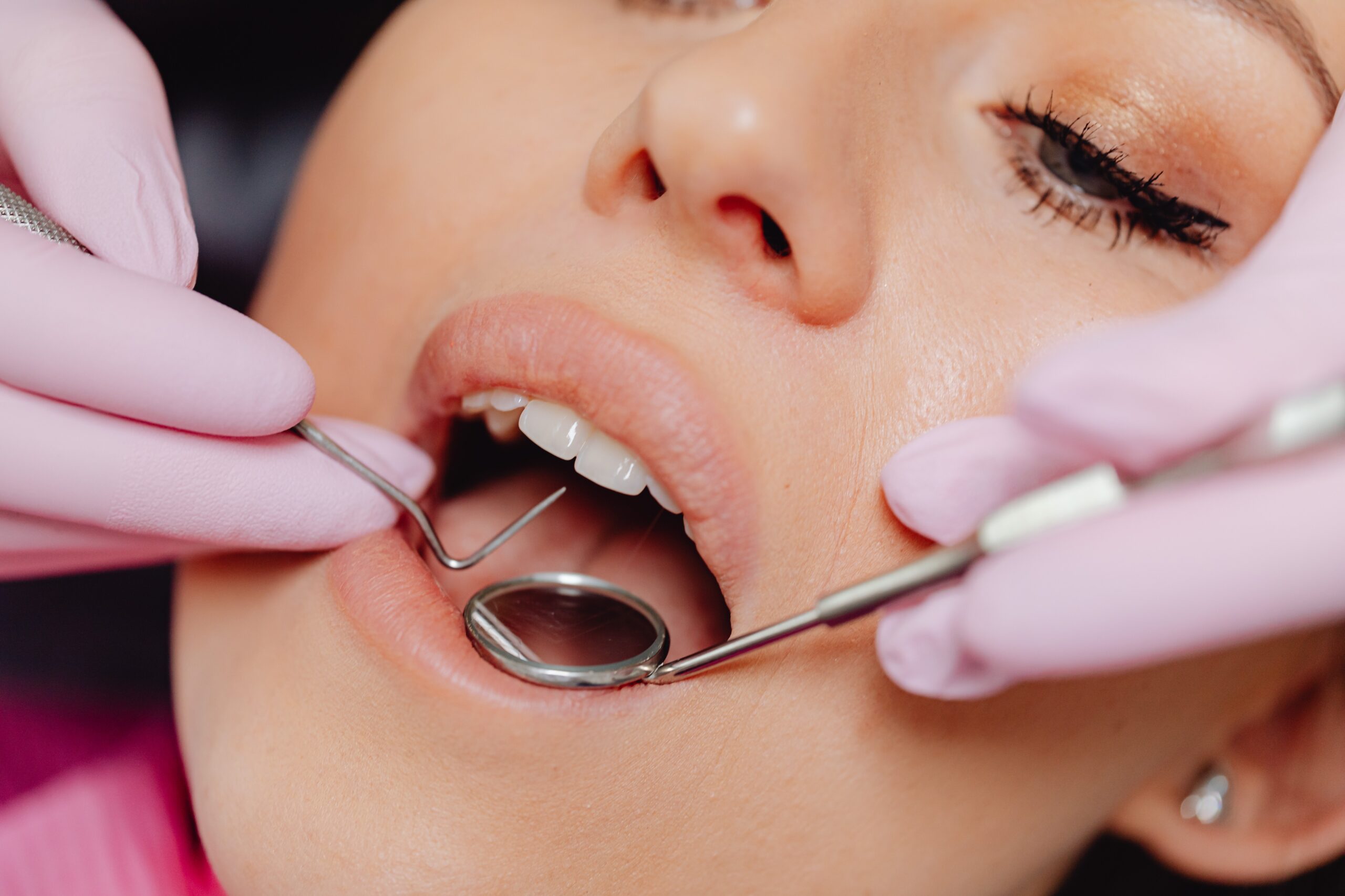 dental hygiene appointment