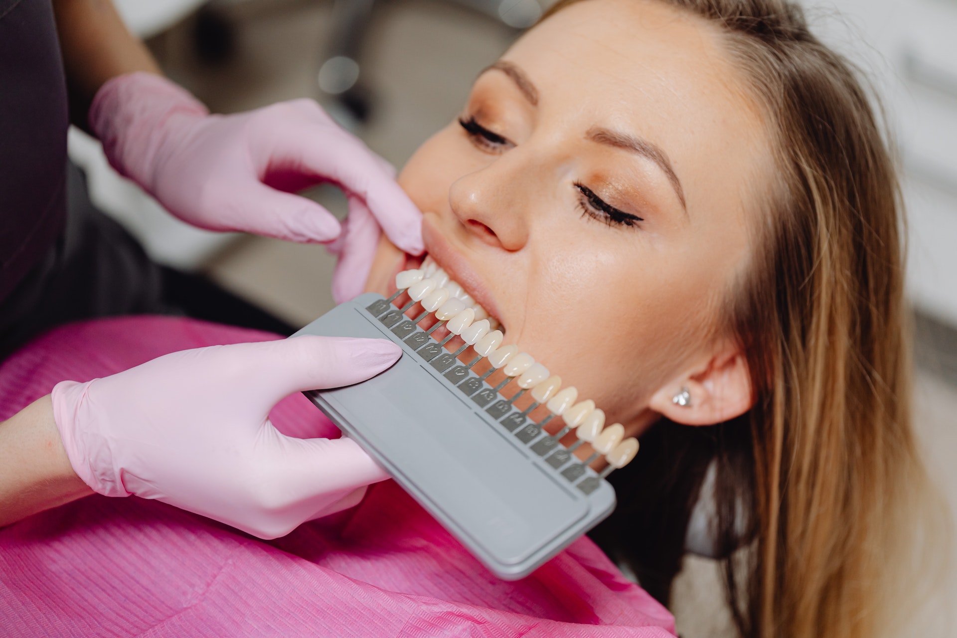 dentist is using shade guide to match to tooth veneer